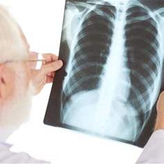 مريض الصّدر في شهر رمضان